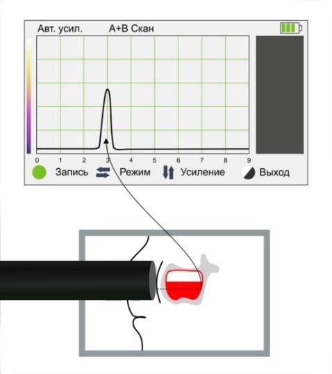 sinuscope_compact_special_8.jpg